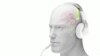 ภาพแอนิเมชั่นของการทำงานของ Neuromodulation