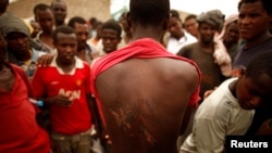 Bakon haure daga Ethiopia yake nuna tabban akubar da masu safarar mutane suka gana masa.