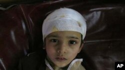 دھماکے میں زخمی ہونے والا ایک بچہ
