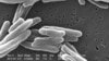 Cifra de casos de tuberculosis en EEUU en 2023 fue la más alta en una década, según reporte